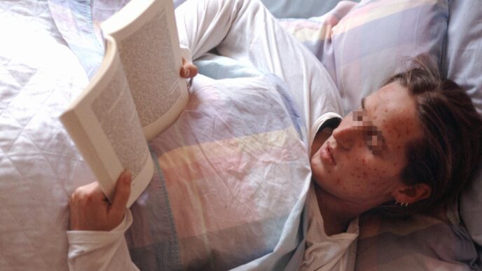Aumento Dei Casi Di Morbillo I