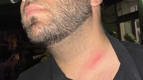 Aggressione In Consiglio Comun