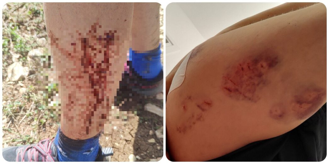 Aggressione Da Cani Pastore Su