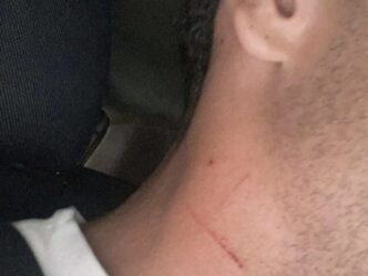 Aggressione A Torre Annunziata