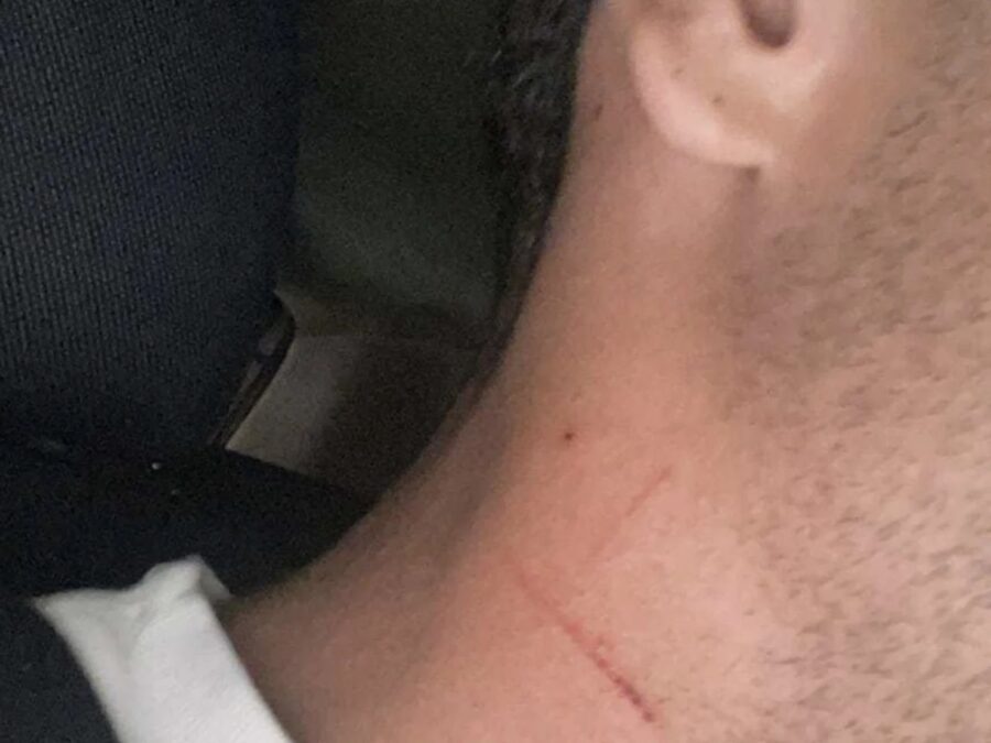 Aggressione A Torre Annunziata