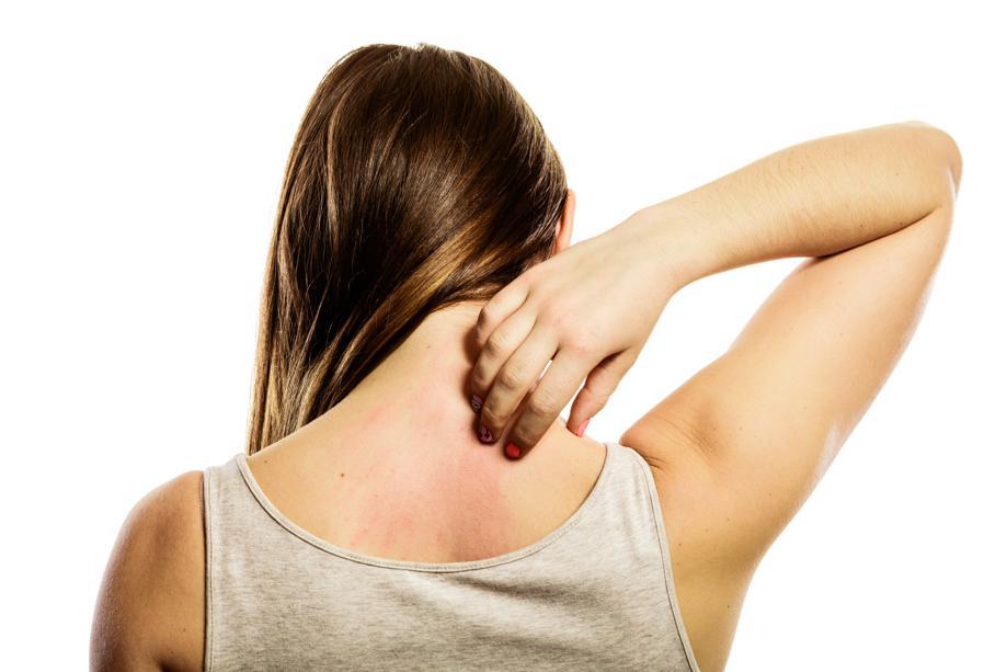 Dermatite Atopica3A Le Novitc3A0 S