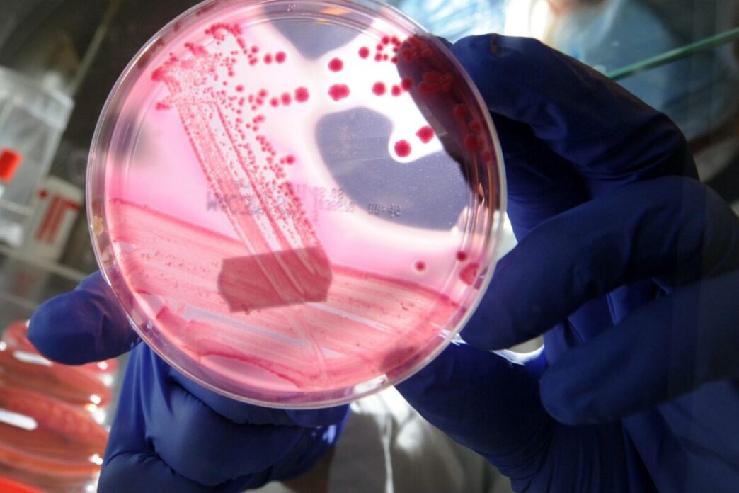 Epidemia Di Escherichia Coli N