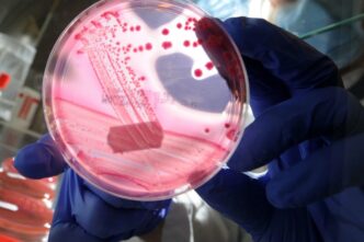 Epidemia Di Escherichia Coli N