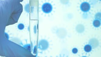 Allerta Sanitaria3A Salmonella