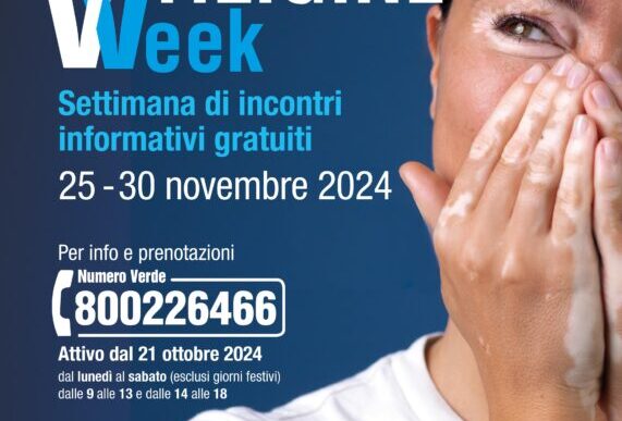 Vitiligine Week3A Iniziativa Na