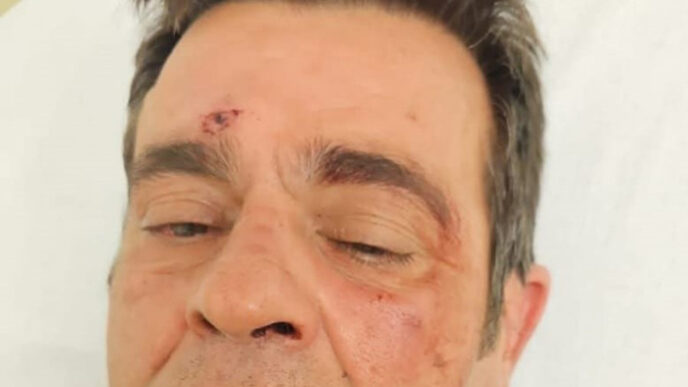 Aggressione A Porto Sant27Elpid 1