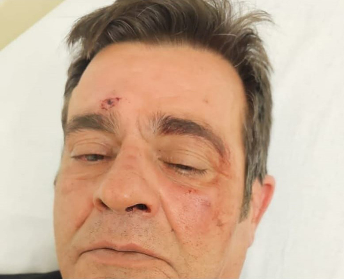 Aggressione A Porto Sant27Elpid 1