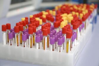 Epidemia Misteriosa In Congo3A