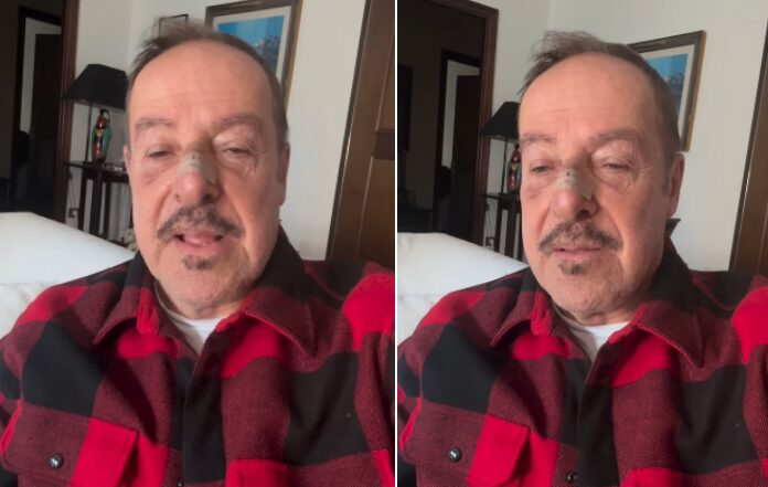 Incidente Per Massimo Lopez Ne