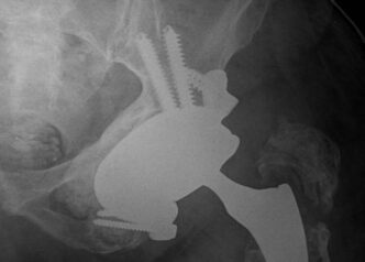 Innovazione Medica A L27Aquila3A
