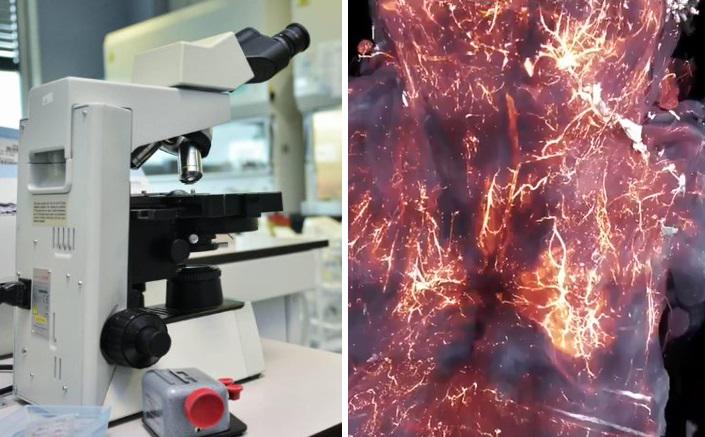 La Persistenza Del Coronavirus