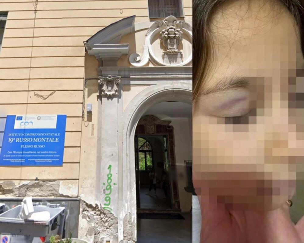 Napoli3A Bambina Di Otto Anni V