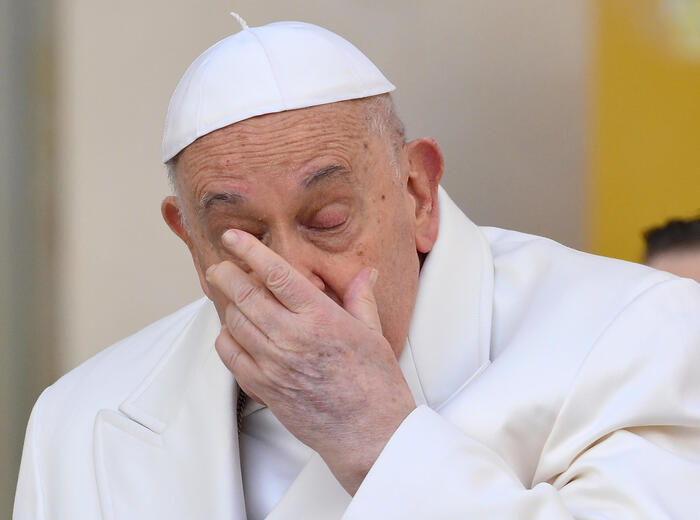 Papa Francesco Affronta Un Leg