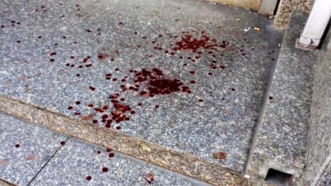 Aggressione A Prato3A Quaranten