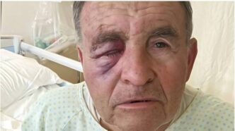 Aggressione A Un Ottantenne In
