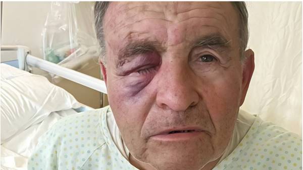 Aggressione A Un Ottantenne In