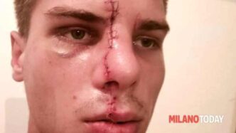 Aggressione Alla Stazione Gari