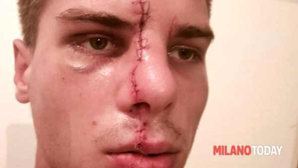 Aggressione Alla Stazione Gari