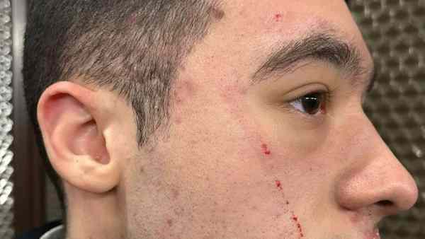 Aggressione Metropolitano3A Nic