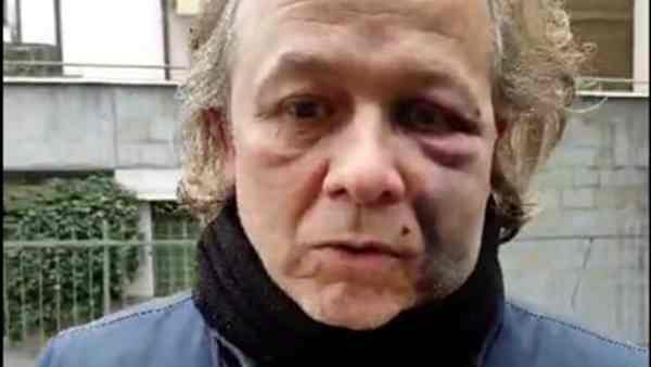 Aggressione Notturna In Via Sa