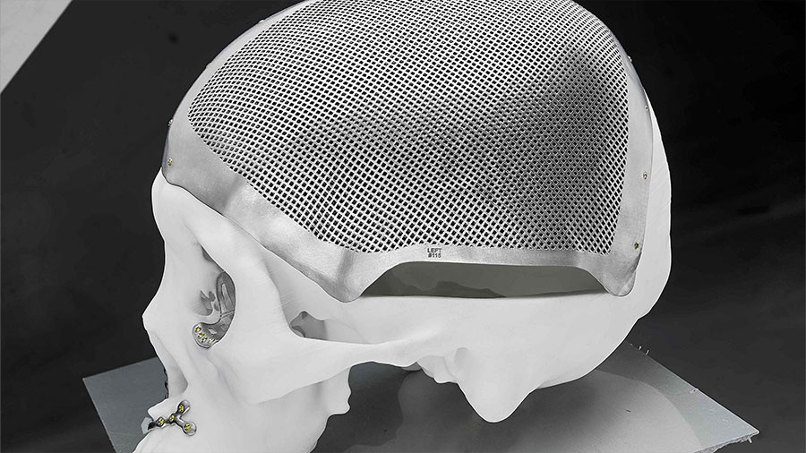 L27Innovazione Della Stampa 3D