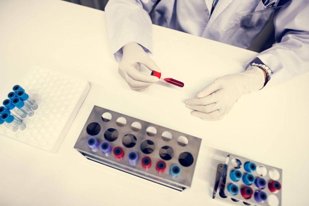 Proposta Di Legge Per Test Ant