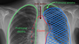 Un Intervento Chirurgico Innov