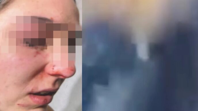 Aggressione A Marano Di Napoli