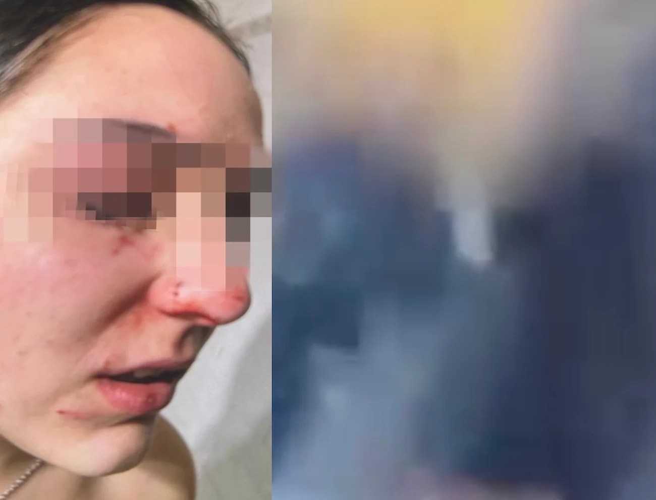 Aggressione A Marano Di Napoli