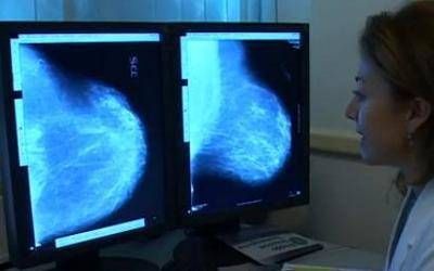 Tumore Al Seno3A Il Peso Della