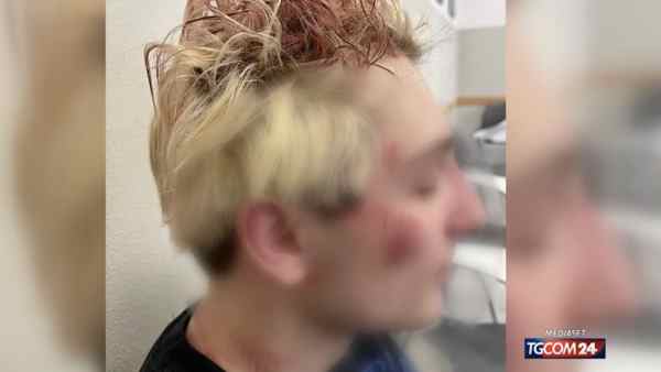 Aggressione Brutale A Milano3A