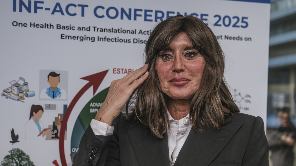 Finanziamento Per La Ricerca3A