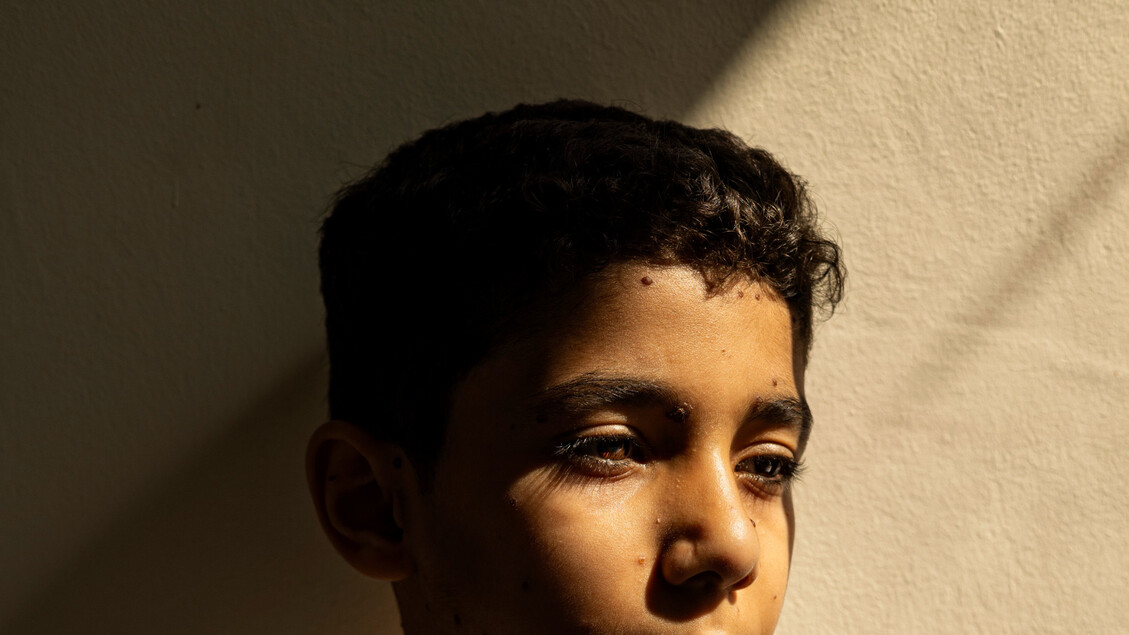 Foto Di Un Dramma Umano3A Il Ri