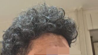 Aggressione A Zagabria Durante