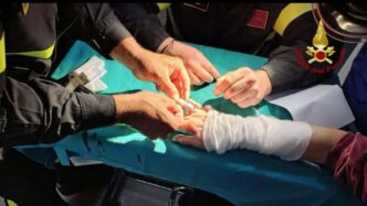 Anelli Bloccati Sulle Dita3A I