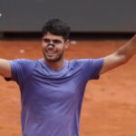 Carlos Alcaraz Agli Internazionali D’Italia 2025 Con Cerotto Nero Sul Naso, Ecco Perché