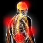 Convegno Sulla Fibromialgia Al Museo Della Terra Pontina Per Sensibilizzare E Informare Il Pubblico