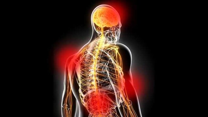 Convegno Sulla Fibromialgia Al
