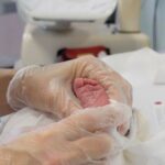 In Liguria Parte Uno Screening Neonatale Per La Celiachia Con Test Genetico Su 1000 Neonati