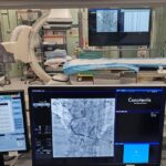 Vent’anni E 30Mila Procedure Al Laboratorio Di Emodinamica Dell’ospedale Mazzoni Di Ascoli Piceno