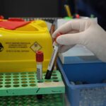 Via Libera Fda Al Primo Test Del Sangue Per Diagnosticare L’alzheimer In Adulti Con Segni Precoci
