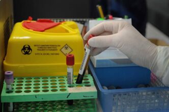 Via Libera Fda Al Primo Test D