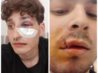 Violenza Nella Movida A Napoli