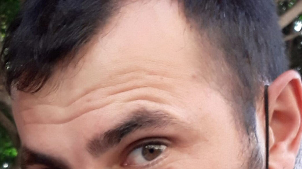 Aggressione Con Olio Bollente