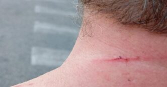 Aggressione In Barriera Di Mil