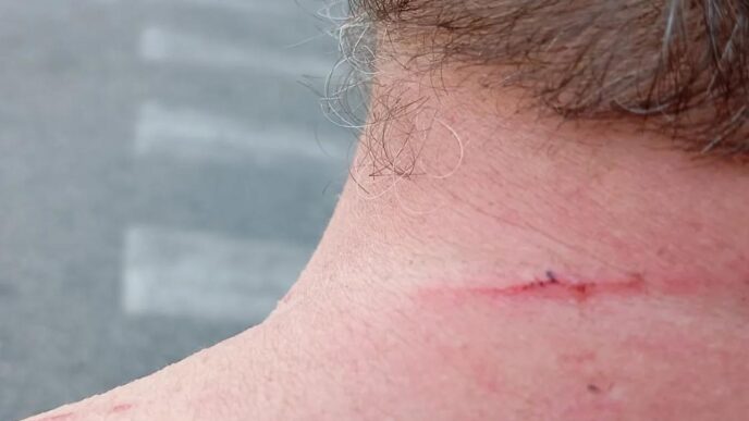 Aggressione In Barriera Di Mil