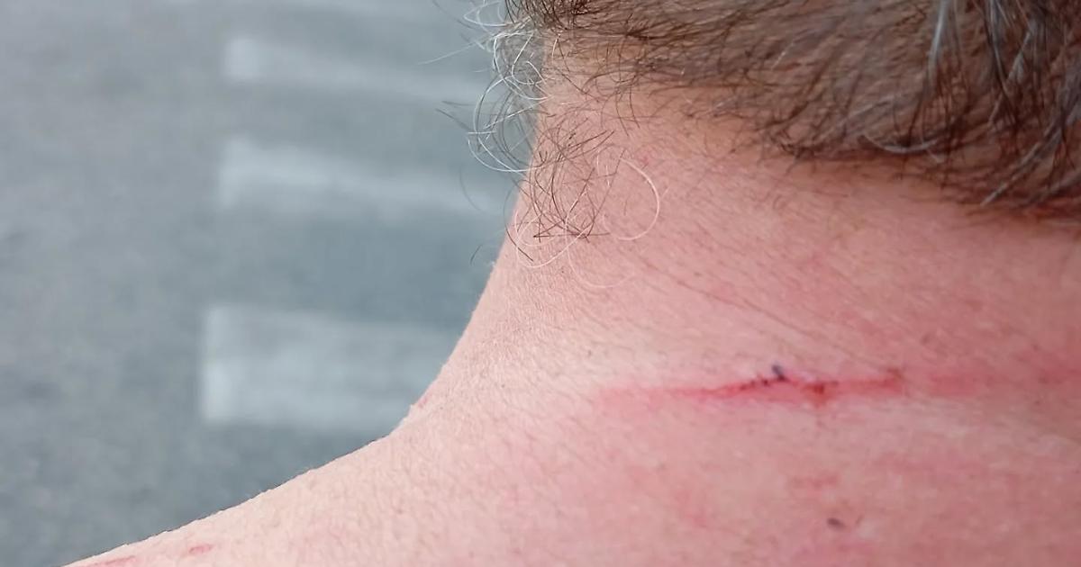 Aggressione In Barriera Di Mil