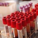 Biomonitoraggio Pfas A Spinetta Marengo, Oltre 700 Preadesioni Per Test Sulla Popolazione Residente