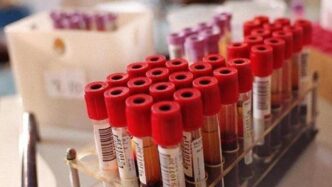 Biomonitoraggio Pfas A Spinett